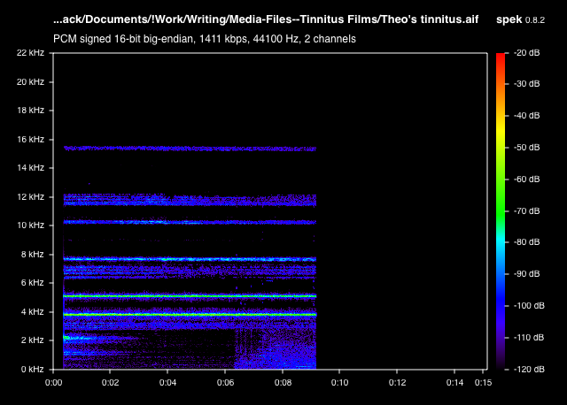Fig. 2:  Tinnitus spectograph